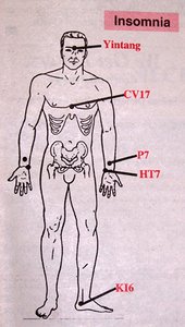 Insomnia Diagram