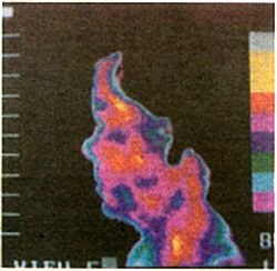 Infrared Side Facial View