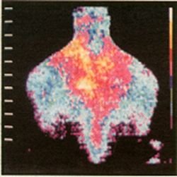 Infrared View of Neck