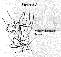 Figure 3A
