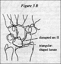 Figure 3B