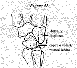 Figure 4A