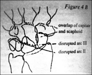 Figure 4B