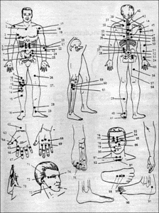 Miracle Points Diagrams
