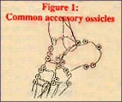Common accessory ossicles