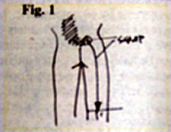 Pain drawing 1