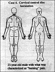 23-year-old male with what was characterized as 