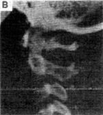 Figure 3B