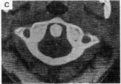 Figure 3C