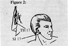Neck Points