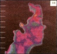 Figure 1B