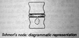 Figure1