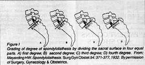 Grading of degree of spondylolisthesis