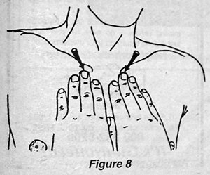 Figure 8