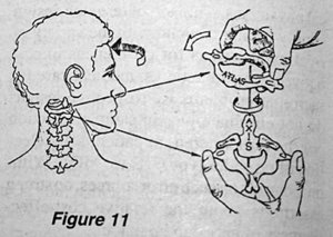 Figure 11