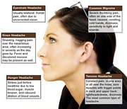 Illustration of different types of headaches.