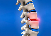 Close-up on a model of a spine.
